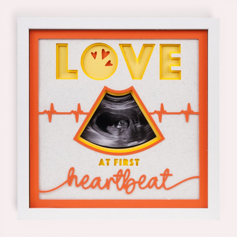 Love at First Heartbeat Photo Frame