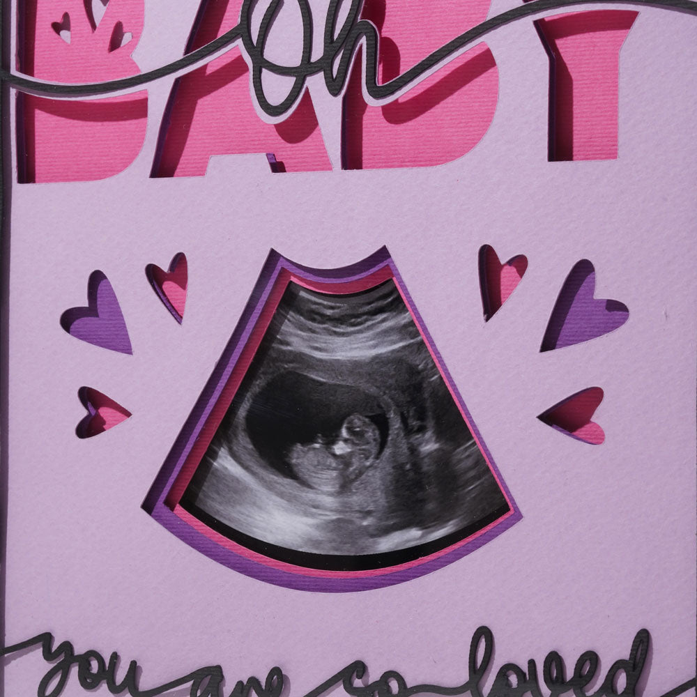 Sonogram Memory Photo Frame