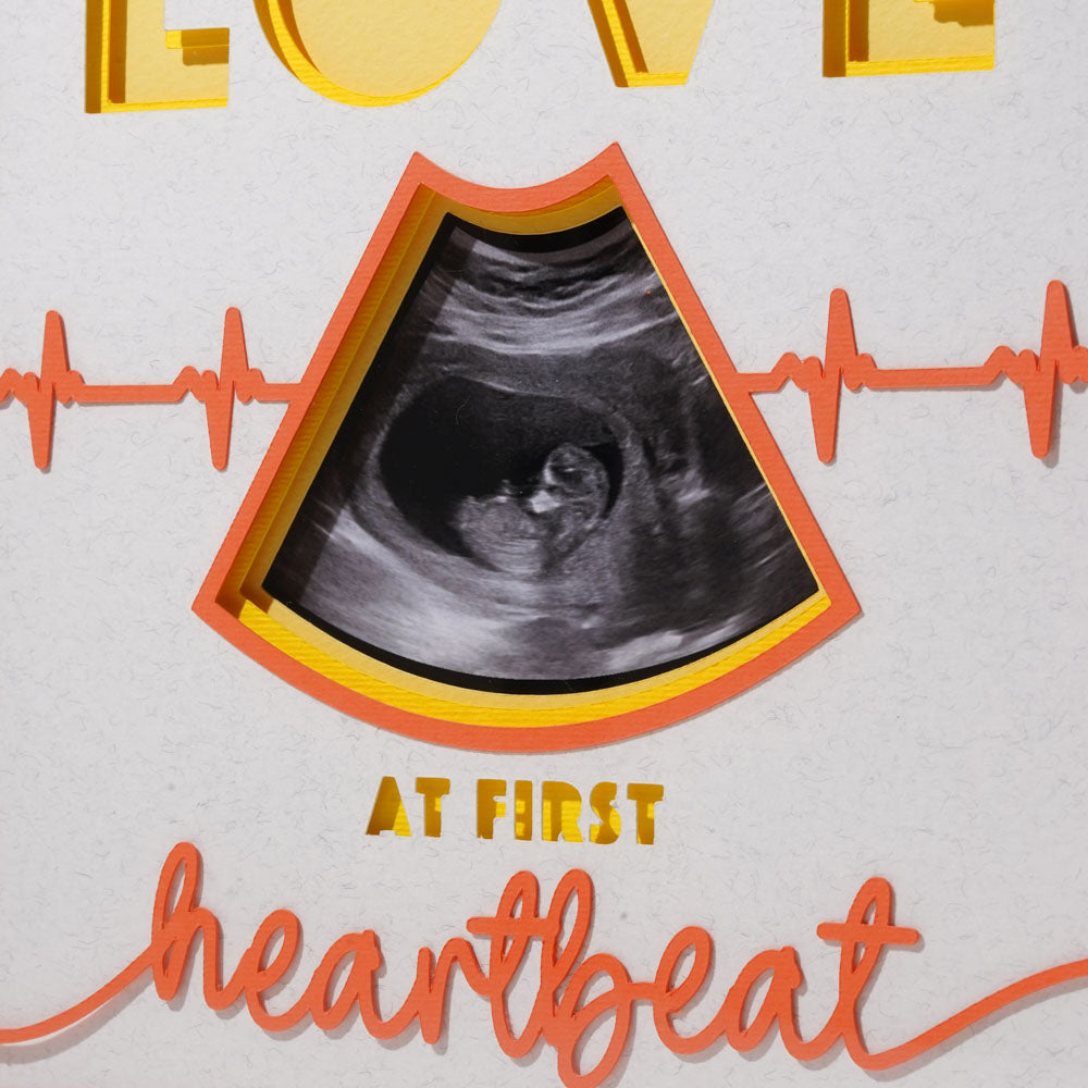 Love at First Heartbeat Photo Frame